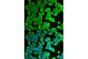 Immunofluorescence analysis of HeLa cells using RPLP0 antibody (ABIN6128685, ABIN6147162, ABIN6147164 and ABIN6217707). (RPLP0 抗体  (AA 1-317))