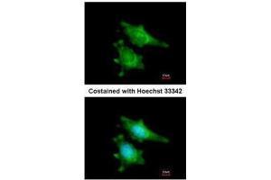 ICC/IF Image Immunofluorescence analysis of methanol-fixed HeLa, using RIP2, antibody at 1:200 dilution. (RIPK2 抗体)