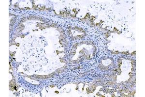 IHC analysis of FOXK1 using anti-FOXK1 antibody (ABIN7600295).