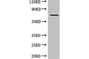 Western Blot Positive WB detected in: MCF-7 whole cell lysate All lanes: GRAMD4 antibody at 5 μg/mL Secondary Goat polyclonal to rabbit IgG at 1/50000 dilution Predicted band size: 67, 11 kDa Observed band size: 67 kDa (GRAMD4 抗体  (AA 23-161))