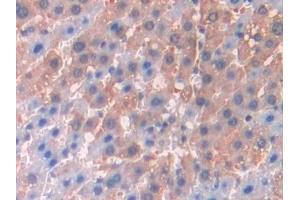Detection of JAK2 in Rat Liver Tissue using Polyclonal Antibody to Janus Kinase 2 (JAK2) (JAK2 抗体  (AA 916-1103))