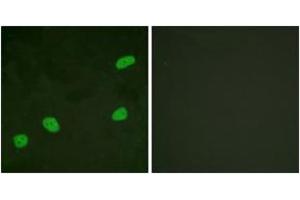 Immunofluorescence (IF) image for anti-ATR Interacting Protein (ATRIP) (AA 34-83) antibody (ABIN2888758) (ATRIP 抗体  (AA 34-83))