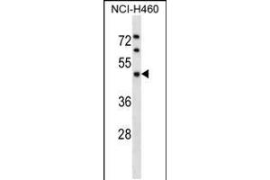 Western blot analysis in NCI-H460 cell line lysates (35ug/lane). (KPTN 抗体  (AA 245-273))