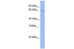 WB Suggested Anti-METTL3 Antibody Titration:  0. (METTL3 抗体  (Middle Region))