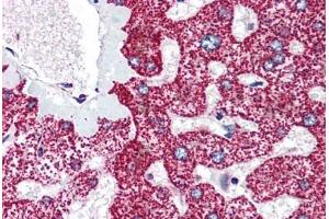 Human Liver (formalin-fixed, paraffin-embedded) stained with LIPG antibody ABIN214182 at 5 ug/ml followed by biotinylated goat anti-rabbit IgG secondary antibody ABIN481713, alkaline phosphatase-streptavidin and chromogen.