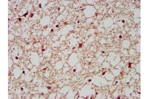 IHC image of ABIN7143995 diluted at 1:200 and staining in paraffin-embedded human brain tissue performed on a Leica BondTM system.