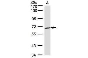 WB Image Sample(30 μg of whole cell lysate) A:MOLT4, 7. (GGT1 抗体)