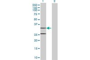 Western Blot analysis of CCDC44 expression in transfected 293T cell line by CCDC44 MaxPab polyclonal antibody. (TACO1 抗体  (AA 1-297))