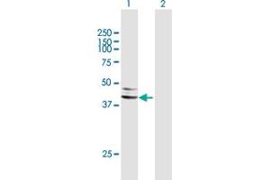 Western Blot analysis of SERPINA5 expression in transfected 293T cell line by SERPINA5 MaxPab polyclonal antibody.