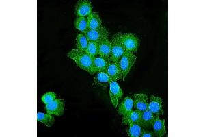 IF analysis of Occludin/OCLN using anti-Occludin/OCLN antibody (ABIN7601995).
