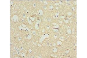 Immunohistochemistry of paraffin-embedded human brain tissue using ABIN7161255 at dilution of 1:100 (NCALD 抗体  (AA 1-193))