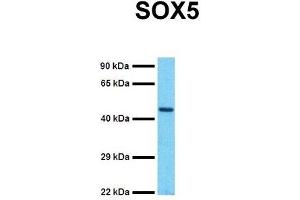 Western Blotting (WB) image for anti-SRY (Sex Determining Region Y)-Box 5 (SOX5) (C-Term) antibody (ABIN2777862)