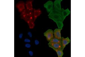 ABIN6255425 and ABIN6266457 staining Hela cells(30 min of UV treatment) by IF/ICC.