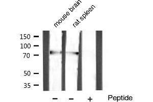 Western blot analysis of extracts of various celllines,using GRP78 Antibody (GRP78 抗体)