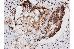 Immunohistochemical staining of paraffin-embedded Human Kidney tissue using anti-PEPD mouse monoclonal antibody. (PEPD 抗体)