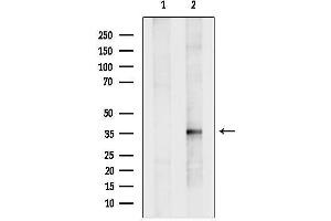 anti-3-hydroxyisobutyrate Dehydrogenase (HIBADH) (Internal Region) antibody
