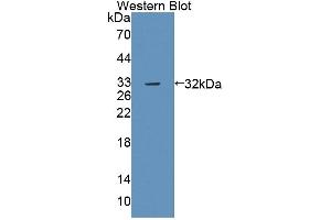 Western Blotting (WB) image for anti-Protein tyrosine Phosphatase, Receptor Type, B (PTPRB) (AA 1214-1463) antibody (ABIN7444100)