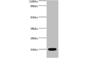 Western blot All lanes: NTS antibody at 2 μg/mL + Mouse small intestine tissue Secondary Goat polyclonal to rabbit IgG at 1/10000 dilution Predicted band size: 20 kDa Observed band size: 20 kDa (Neurotensin 抗体  (AA 24-143))