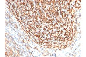 Formalin-fixed, paraffin-embedded human Tonsil Dendritic stained with CD21-Monospecific Mouse Monoclonal Antibody (CR2/2754).