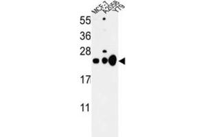 Western Blotting (WB) image for anti-Chromobox Homolog 1 (CBX1) antibody (ABIN3003963) (CBX1 抗体)