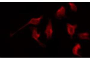 ABIN6276061 staining NIH-3T3 by IF/ICC. (NPY1R 抗体  (Internal Region))