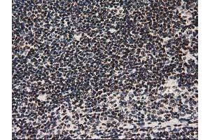 Image no. 7 for anti-Nonhomologous End-Joining Factor 1 (NHEJ1) antibody (ABIN1499729) (NHEJ1 抗体)