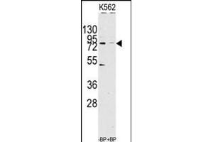 Western blot analysis of anti-JHDM1a/FBXL11 Antibody (C-term) (ABIN1536624 and ABIN2844141) pre-incubated with(right lane) and without(left lane) blocking peptide in Jurkat cell line lysate. (KDM2A 抗体  (C-Term))
