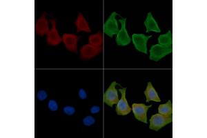 ABIN6260628 and ABIN6276794 staining Hela cells(30 min of UV treatment) by IF/ICC.