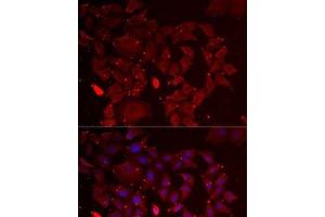 Immunofluorescence analysis of MCF7 cells using ADSS Polyclonal Antibody (ADSS 抗体)