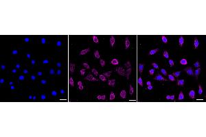 Immunocytochemical staining of Hela cells with Keratin 13 antibody (ABIN7799165), 1:1,000). (Recombinant Cytokeratin 13 抗体)