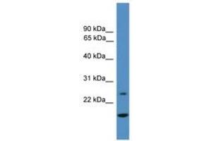 Image no. 1 for anti-Tissue Factor Pathway Inhibitor 2 (TFPI2) (AA 21-70) antibody (ABIN6745333) (TFPI2 抗体  (AA 21-70))