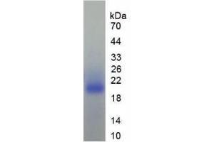 SDS-PAGE analysis of Human TGFb1I1 Protein. (TGFB1I1 蛋白)