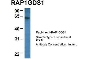 Host: Rabbit  Target Name: RAP1GDS1  Sample Tissue: Human Fetal Brain  Antibody Dilution: 1. (RAP1GDS1 抗体  (Middle Region))