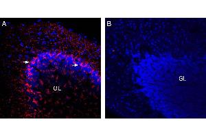Immunohistochemistry (IHC) image for anti-Solute Carrier Family 32 (GABA Vesicular Transporter), Member 1 (SLC32A1) (AA 106-120), (Cytosolic) antibody (ABIN7043718)