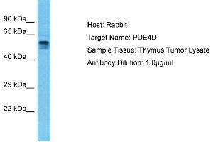 Host: Rabbit Target Name: PDE4D Sample Type: Thymus Tumor lysates Antibody Dilution: 1. (PDE4D 抗体  (C-Term))