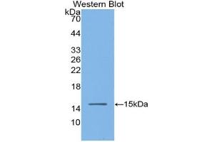 Western blot analysis of the recombinant protein. (Angiotensin I Converting Enzyme 1 抗体  (AA 334-409))