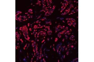 IF analysis of SNRPN using anti-SNRPN antibody (ABIN3043934).