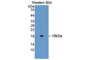 Western blot analysis of the recombinant protein. (TRAPPC2 抗体  (AA 1-140))