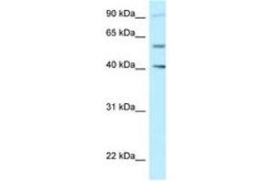 Image no. 1 for anti-SHC SH2-Domain Binding Protein 1-Like (SHCBP1L) (AA 525-574) antibody (ABIN6747880) (SHCBP1L 抗体  (AA 525-574))