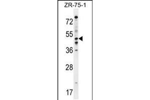 Western blot analysis in ZR-75-1 cell line lysates (35ug/lane). (PDE7B 抗体  (C-Term))