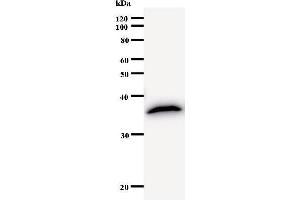 Western Blotting (WB) image for anti-Cyclin T2 (CCNT2) antibody (ABIN930980)