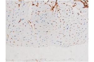 ABIN6267528 at 1/200 staining Mouse heart tissue sections by IHC-P. (SAPK, JNK (pThr183) 抗体)