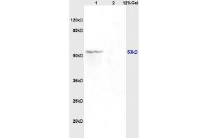 SDS-PAGE (SDS) image for anti-Tumor Protein P53 (TP53) (acLys382) antibody (ABIN729673)