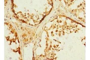 Immunohistochemistry of paraffin-embedded human testis tissue using ABIN7150046 at dilution of 1:100 (ADAM19 抗体  (AA 203-460))