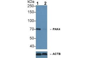 Western blot analysis of (1) Wild-type HeLa cell lysate, and (2) PAK4 knockout HeLa cell lysate, using Rabbit Anti-Human PAK4 Antibody (1 µg/ml) and HRP-conjugated Goat Anti-Rabbit antibody (abx400043, 0. (PAK4 抗体  (AA 299-542))