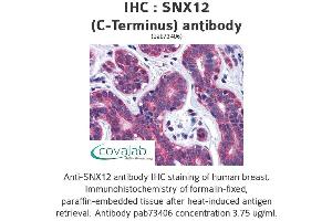 Image no. 2 for anti-Sorting Nexin 12 (SNX12) (C-Term) antibody (ABIN1739487) (SNX12 抗体  (C-Term))