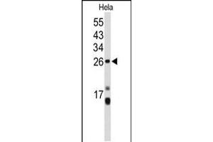 Western blot analysis of CENPH Antibody in Hela cell line lysates (35ug/lane) (CENPH 抗体  (AA 136-162))