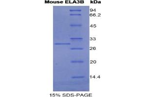 SDS-PAGE analysis of Mouse Elastase 3B Protein. (Elastase 3B 蛋白)