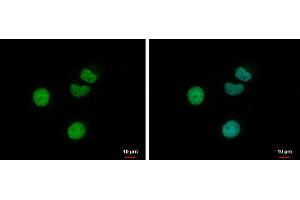 ICC/IF Image Retinoic Acid Receptor gamma antibody detects Retinoic Acid Receptor gamma protein at nucleus by immunofluorescent analysis. (Retinoic Acid Receptor gamma 抗体)