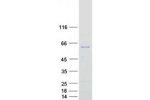Western Blotting (WB) image for 60S Ribosomal Export Protein NMD3 (NMD3) protein (Myc-DYKDDDDK Tag) (ABIN2727390)